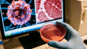 medical researcher in blue gloves holds a petri dish with red liquid in a laboratory setting, with a computer screen displaying microscopic images of a mesenchymal stem cell